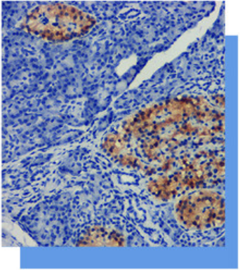 Protein Gene Product 9.5抗體試劑