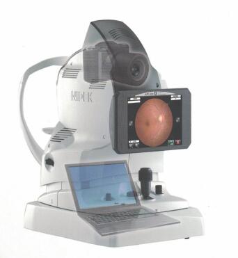 尼德克自動免散瞳眼底照相機(jī)AFC-330