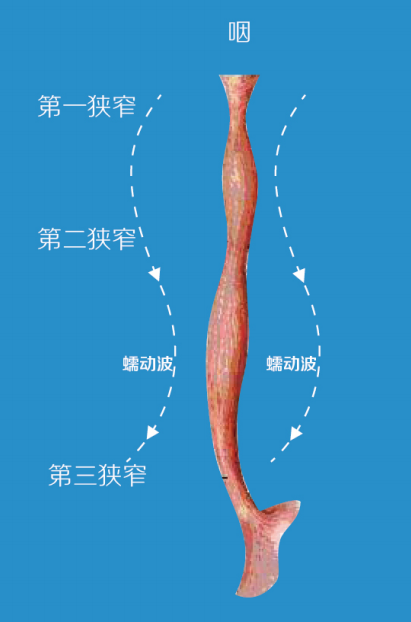 Sigma仿生食管支架